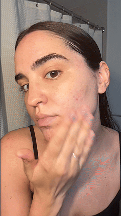 How to Support a Friend Who’s Struggling With Their Skin