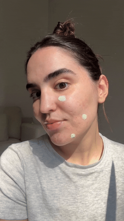 How to Treat a Pimple Fast (Without Going Overboard)