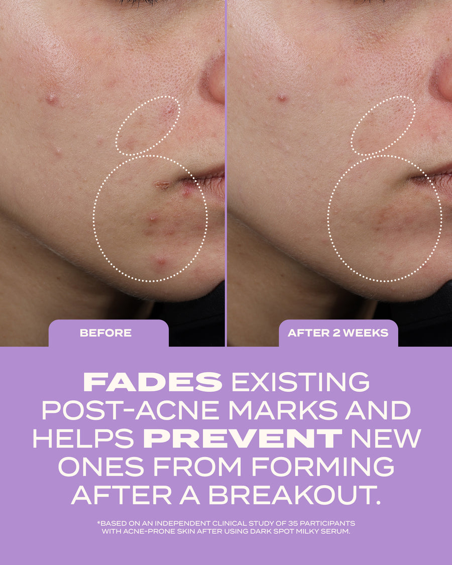 Helps prevent new marks
