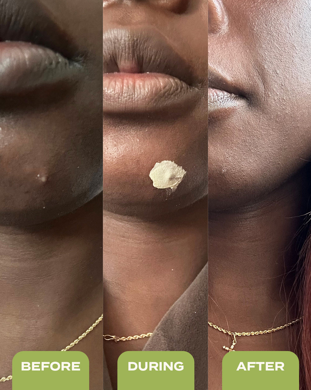 10% Sulfur Spot Treatment