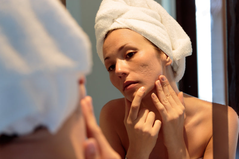 a woman with textured skin looking in the mirror holding her cheek wearing a white towel on her head