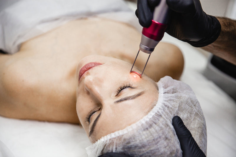 Laser Therapy for Acne Scars: When It’s Time and What to Know