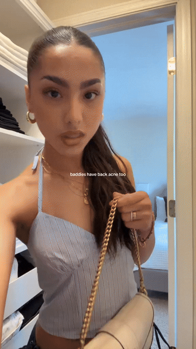 girl showing body acne on back