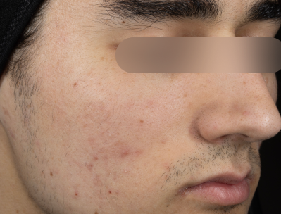 After using the product