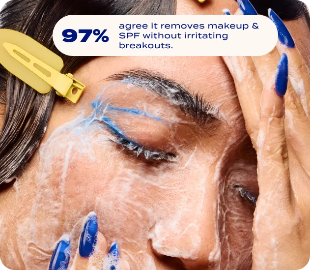 Gentle on active breakouts