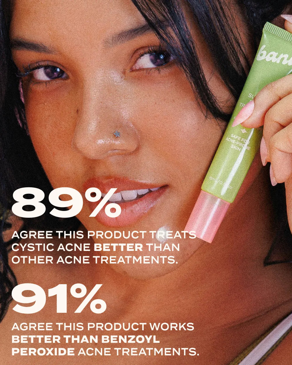 Sulfur Spot Treatment clinical results