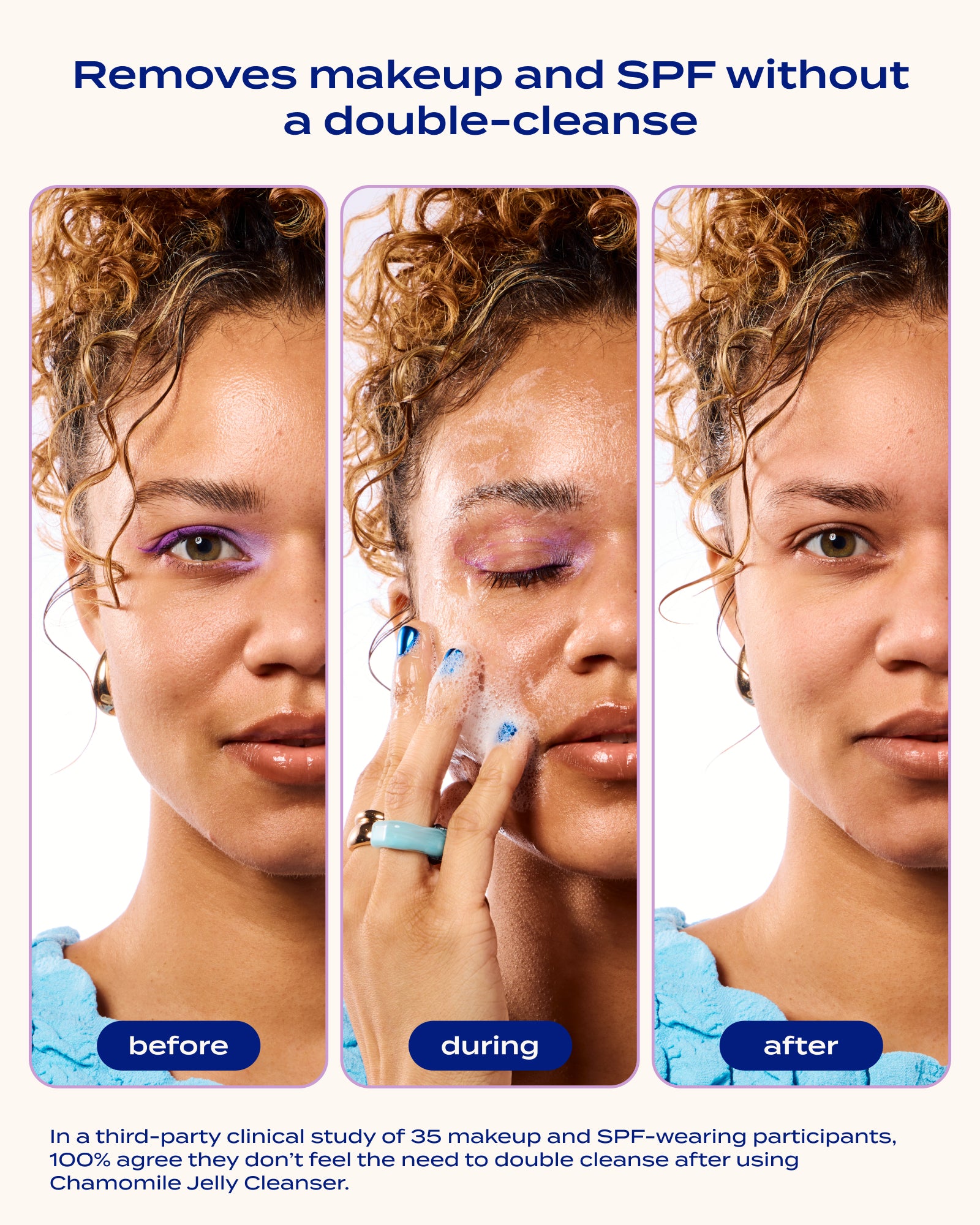 Clear Acne in 90 Days Bundle – Breakout Prevention Kit – banuskin