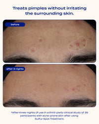 Sulfur Spot Treatment