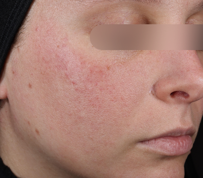 After using the product