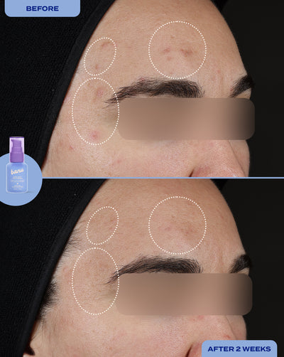 Treat, Fade & Prevent Routine