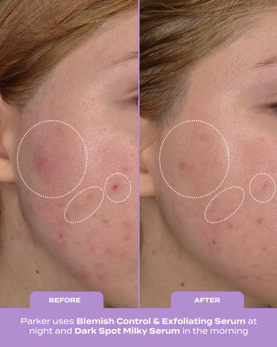 Treat, Fade & Prevent Routine