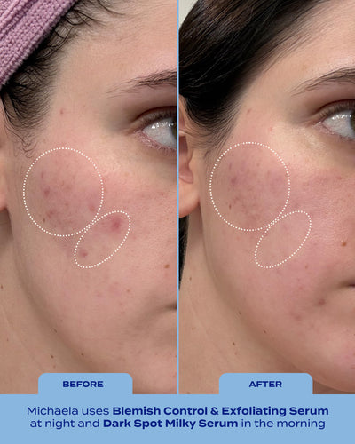 Treat, Fade & Prevent Routine