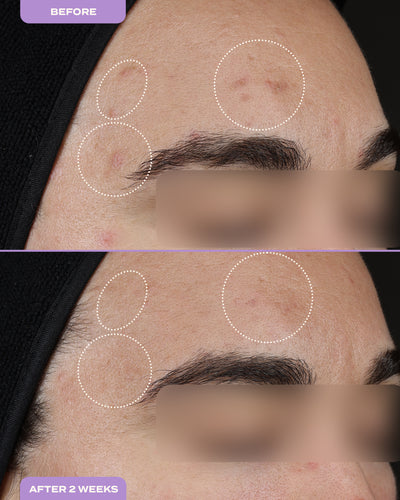 Dark Spot Milky Serum