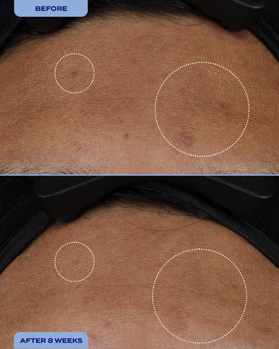 Dark Spot Milky Serum