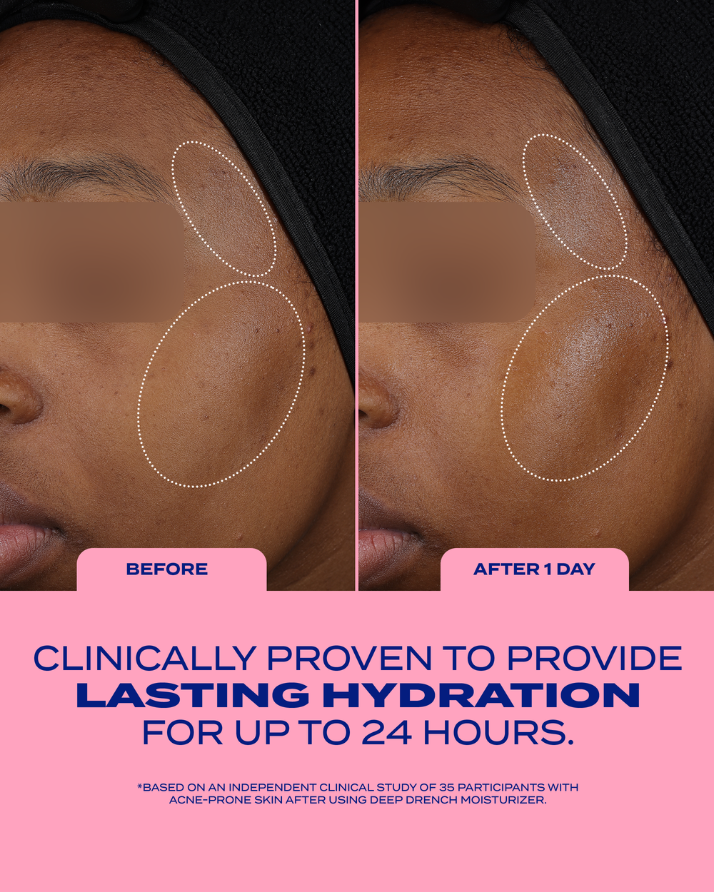 Deep Drench Lightweight Moisturizer