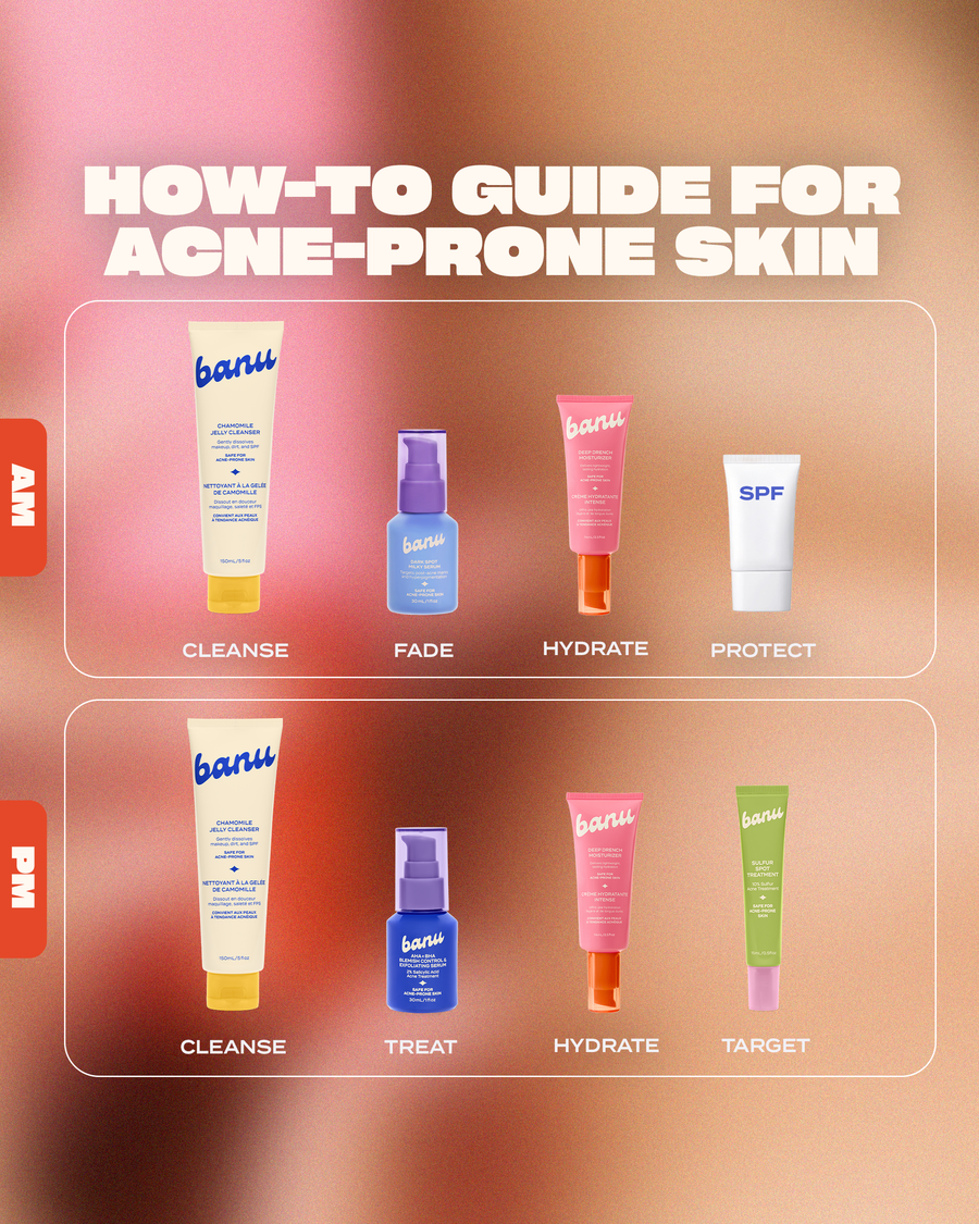 Complete Acne-Clearing System