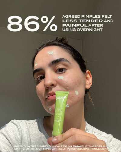 10% Sulfur Spot Treatment