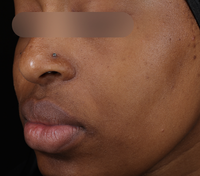 Before using Deep Drench Moisturizer