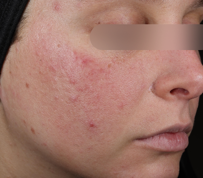 Before using the product