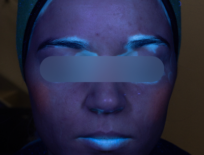 Before using the product