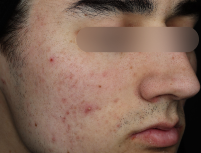 Before using the product