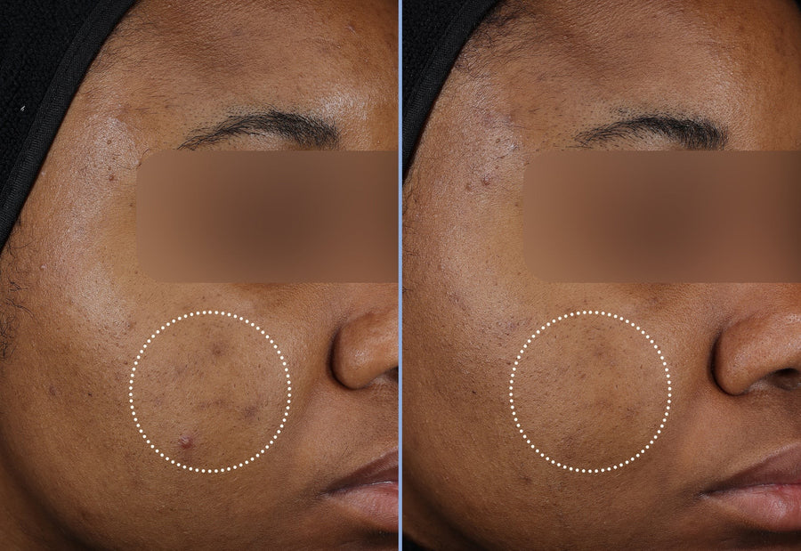Evens and brightens skin tone